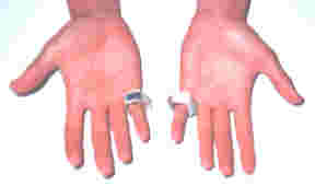 Archivo:Handring.jpg
