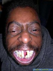 Rober_vlc antes de su operacion de estetica